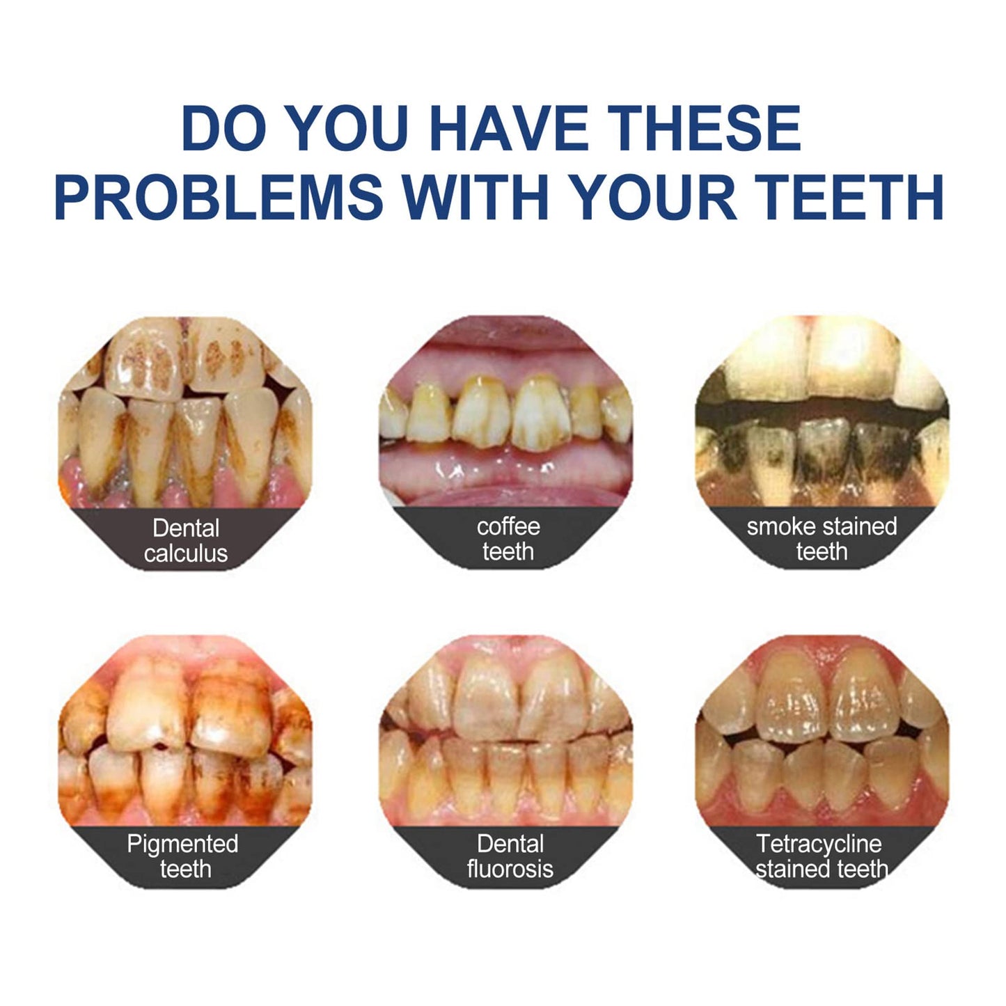 New 7-Pro Intensive Toothpaste | Upgraded Purple Formula with 7 Probiotics | Deep Enamel Repair & Long-Lasting Freshness#dealsforyoudays