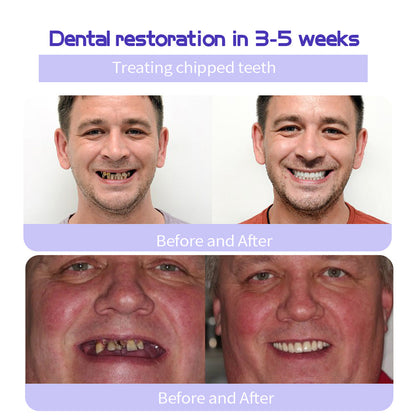 New 7-Pro Intensive Toothpaste | Upgraded Purple Formula with 7 Probiotics | Deep Enamel Repair & Long-Lasting Freshness#dealsforyoudays