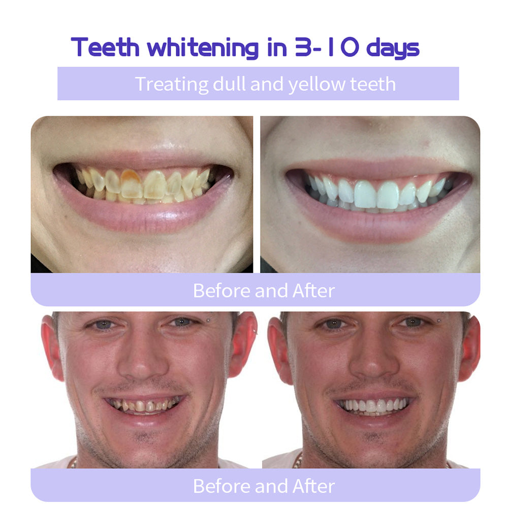 New 7-Pro Intensive Toothpaste | Upgraded Purple Formula with 7 Probiotics | Deep Enamel Repair & Long-Lasting Freshness#dealsforyoudays