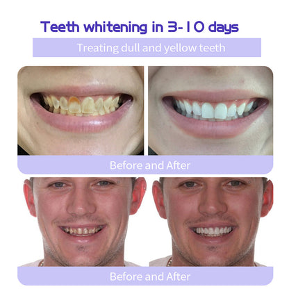 New 7-Pro Intensive Toothpaste | Upgraded Purple Formula with 7 Probiotics | Deep Enamel Repair & Long-Lasting Freshness#dealsforyoudays